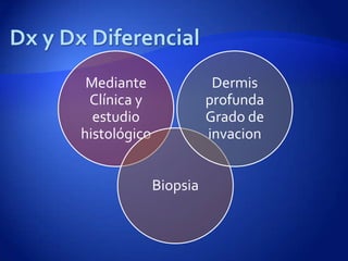 Mediante                Dermis
 Clínica y              profunda
  estudio               Grado de
histológico             invacion


              Biopsia
 