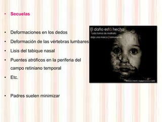 • Secuelas



• Deformaciones en los dedos

• Deformación de las vértebras lumbares

• Lisis del tabique nasal

• Puentes atróficos en la periferia del
   campo retiniano temporal

• Etc.



• Padres suelen minimizar
 