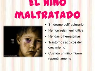 El niño
maltratado
    • Síndrome polifracturario
    • Hemorragia meningítica
    • Heridas o hematomas
    • Trastornos atípicos del
      crecimiento
    • Cuando un niño muere
      repentinamente
 