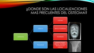 ¿DONDE SON LAS LOCALIZACIONES
MAS FRECUENTES DEL OSTEOMA?
osteoma
clásico
cráneo
Senos maxilares
maxilares
Parosteal
Huesos largos
(fémur, humero,
tibia(porciòn
media)
 