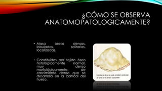 ¿CÓMO SE OBSERVA
ANATOMOPATOLOGICAMENTE?
• Masa óseas densas,
lobuladas, solitarias,
localizadas.
• Constituidas por tejido óseo
histológicamente normal,
muy denso
morfológicamente, de
crecimiento denso que se
desarrolla en la cortical del
hueso.
 