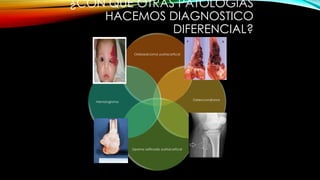 ¿CON QUE OTRAS PATOLOGÍAS
HACEMOS DIAGNOSTICO
DIFERENCIAL?
Osteosarcoma yuxtacortical
Osteocondroma
Lipoma osificado yuxtacortical
Hemangioma
 