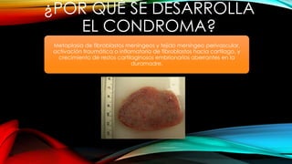 ¿POR QUÉ SE DESARROLLA
EL CONDROMA?
Metaplasia de fibroblastos meníngeos y tejido meníngeo perivascular,
activación traumática o inflamatoria de fibroblastos hacia cartílago, y
crecimiento de restos cartilaginosos embrionarios aberrantes en la
duramadre.
 