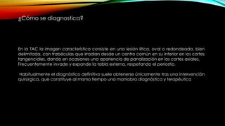 ¿Cómo se diagnostica?
En la TAC la imagen característica consiste en una lesión lítica, oval o redondeada, bien
delimitada, con trabéculas que irradian desde un centro común en su interior en los cortes
tangenciales, dando en ocasiones una apariencia de panalización en los cortes axiales.
Frecuentemente invade y expande la tabla externa, respetando el periostio.
Habitualmente el diagnóstico definitivo suele obtenerse únicamente tras una intervención
quirúrgica, que constituye al mismo tiempo una maniobra diagnóstica y terapéutica
 