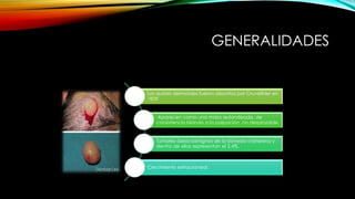 GENERALIDADES
Los quistes dermoides fueron descritos por Cruveilhier en
1829.
Aparecen como una masa redondeada, de
consistencia blanda a la palpación, no desplazable.
Tumores óseos benignos de la bóveda craneana y
dentro de ellos representan el 2,4%.
Crecimiento extracraneal.
 
