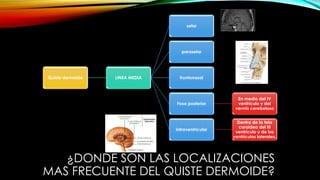 ¿DONDE SON LAS LOCALIZACIONES
MAS FRECUENTE DEL QUISTE DERMOIDE?
Quiste dermoide LINEA MEDIA
selar
paraselar
frontonasal
Fosa posterior
En medio del IV
ventrículo y del
vermis cerebeloso
intraventricular
Dentro de la tela
coroidea del III
ventrículo y de los
ventrículos laterales.
 