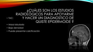 ¿CUÁLES SON LOS ESTUDIOS
RADIOLÓGICOS PARA APOYARME
Y HACER UN DIAGNOSTICO DE
QUISTE EPIDERMOIDE ?
• TAC:
• Masa lobulada
• Baja densidad
• Puede presentar calcificación
 