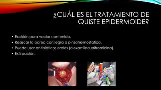 ¿CUÁL ES EL TRATAMIENTO DE
QUISTE EPIDERMOIDE?
• Excisión para vaciar contenido.
• Resecar la pared con legra o pinzahemostatica.
• Puede usar antibióticos orales (cloxacilina,eritromicina).
• Extirpación.
 