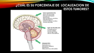 ¿CUÁL ES SU PORCENTAJE DE LOCALIZACION DE
ESTOS TUMORES?
 