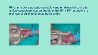 • Pinchar la piel y posteriormente la vena en dirección contraria
al flujo sanguíneo, con un ángulo entre 15º y 30º respecto a la
piel, con el bisel de la aguja hacia arriba
 