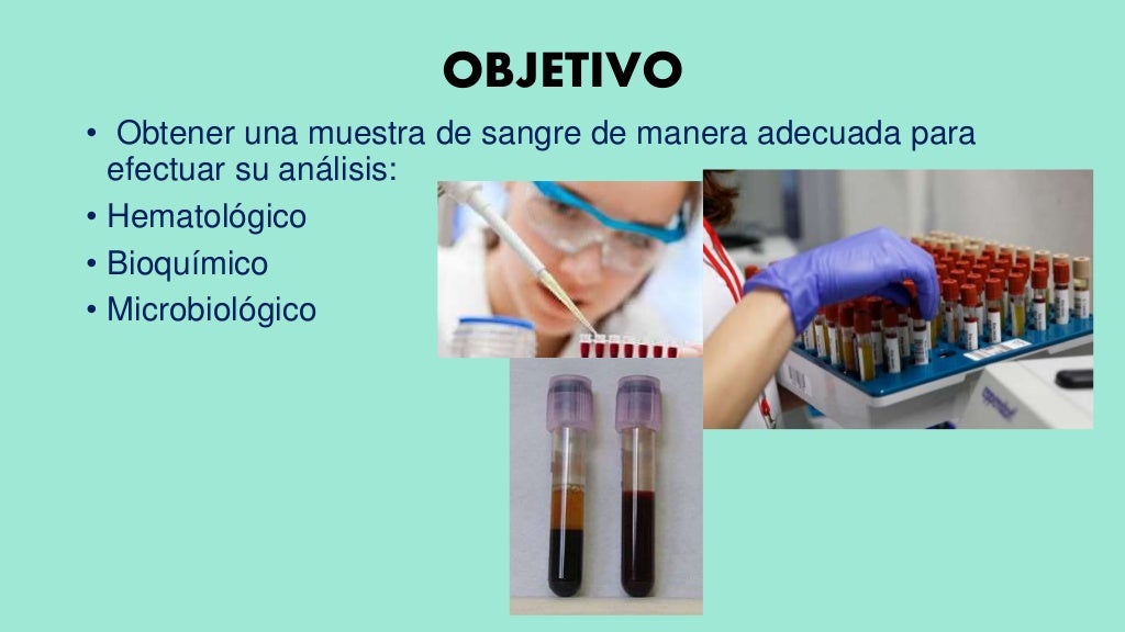 Tecnica de extraccion de sangre