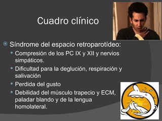 Cuadro clínico Síndrome del espacio retroparotídeo : Compresión de los PC IX y XII y nervios simpáticos. Dificultad para la deglución, respiración y salivación Perdida del gusto Debilidad del músculo trapecio y ECM, paladar blando y de la lengua  homolateral. 