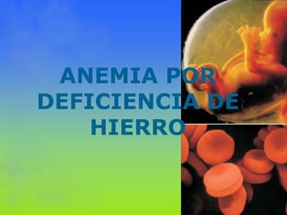 ANEMIA POR
DEFICIENCIA DE
    HIERRO
 