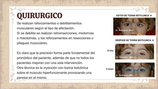 QUIRURGICO
Se realizan reforzamientos o debilitamientos
musculares según el tipo de afectación.
Si se debilita se realizan retroinserciones, miotomías
o miectomiás, y los reforzamientos en resecciones o
pliegues musculares.
Es claro que la precisión forma parte fundamental del
pronóstico del paciente, además de que no todos los
pacientes mejoran con una sola intervención.
Otra técnica es la inyección con toxina botulínica
sobre el músculo hiperfuncionante provocando una
paresia en el mismo.
 