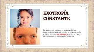 La exotropía constante se caracteriza
porque la desviación ocular en divergencia
existe de modo permanente, sin intervalos
de paralelismo de los ejes oculares.
EXOTROPÍA
CONSTANTE
 