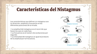 Características del Nistagmus
Las características que deﬁnen un nistagmus son
su dirección, amplitud y frecuencia en las
diferentes posiciones de la mirada.
• La amplitud del nistagmus es el recorrido que
hacen los ojos en cada fase.
• La frecuencia es el número de oscilaciones por
segundo.
• La intensidad del nistagmus es igual al producto
de la amplitud por la frecuencia.
 