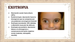 EXOTROPIA
● Desviación ocular hacia afuera
(30%)
● Exoforia-tropia: desviación hacia la
divergencia que se compensa por
una poderosa convergencia fusional
● Exotropia (constante): 50% debidas
a alteración muscular de oblicuos
● Exotropia secuandaria: desviación
básica a la divergencia a
consecuencia de lesión orgánica
ocular (catarata, retinopatía,
neuritis)
 