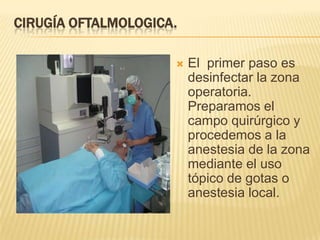 CIRUGÍA OFTALMOLOGICA.
 El primer paso es
desinfectar la zona
operatoria.
Preparamos el
campo quirúrgico y
procedemos a la
anestesia de la zona
mediante el uso
tópico de gotas o
anestesia local.
 