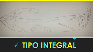  TIPO INTEGRAL

 