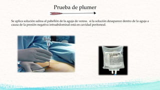 Prueba de plumer
Se aplica solución salina al pabellón de la aguja de veress. si la solución desaparece dentro de la aguja a
causa de la presión negativa intraabdominal está en cavidad peritoneal.
 