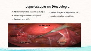 Laparoscopia en Ginecología
• Menor sangrado y trauma quirúrgico
• Menor requerimiento analgésico
• Corta recuperación
• Menor tiempo de hospitalización.
• en ginecología y obstetricia.
 