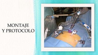MONTAJE
Y PROTOCOLO
 