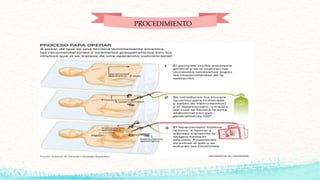PROCEDIMIENTO
 
