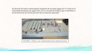las técnicas de sutura extracorpórea requieren de un porta agujas de 3 o 5 mm en el
cual puede montarse una aguja recta, curva o en palo de hockey, que se introduce a
través del trocar de 10 mm provisto de un reductor adecuado.
 
