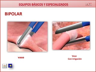 BIPOLAR
Vaso
Con irrigación
vaso
 