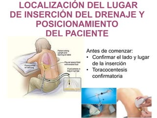 LOCALIZACIÓN DEL LUGAR
DE INSERCIÓN DEL DRENAJE Y
POSICIONAMIENTO
DEL PACIENTE
Antes de comenzar:
• Confirmar el lado y lugar
de la inserción
• Toracocentesis
confirmatoria
 