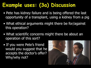 • Pete has kidney failure and is being offered the last
opportunity of a transplant, using a kidney from a pig
• What ethical arguments might there be for/against
this operation?
• What scientific concerns might there be about an
operation of this sort?
• If you were Pete’s friend
would you suggest that he
accepts the doctor’s offer?
Why/why not?
Example uses: (3a) Discussion
 