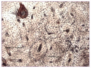 Conducto de Havers Osteoplastos