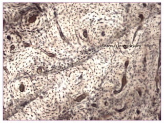 Sistemas intersticiales