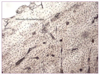 Sistemas circunferenciales