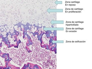 Zona cartílago En reposo Zona de cartílago En proliferación Zona de cartílago hipertrofiado Zona de cartílago En erosión Zona de osificación