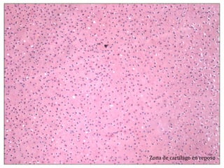 Zona de cartílago en reposo