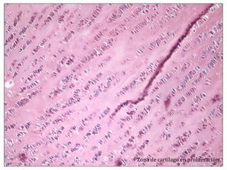 Zona de cartílago en proliferación