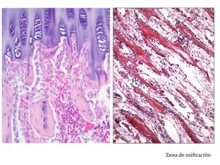 Zona de osificación
