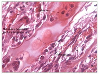 Osteoblasto Osteocito Matriz ósea depositada por los osteoblastos