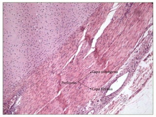 Periostio Capa osteógena Capa fibrosa