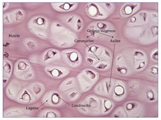 Matriz Laguna Condrocito Grupos isógenos Coronarios Axiles