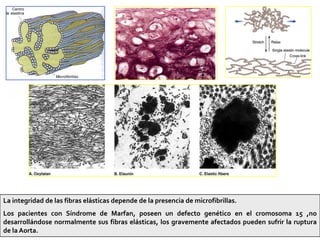 La integridad de las fibras elásticas depende de la presencia de microfibrillas.
Los pacientes con Síndrome de Marfan, poseen un defecto genético en el cromosoma 15 ,no
desarrollándose normalmente sus fibras elásticas, los gravemente afectados pueden sufrir la ruptura
de la Aorta.                                                                                   22
 