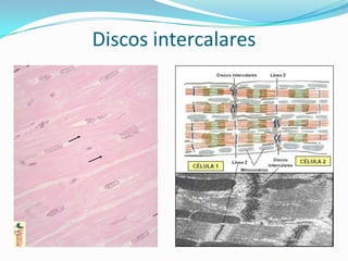 Discos intercalares
 