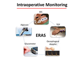 Intraoperative Monitoring
Hypnosis
Muscle
relaxation
Cardiac
output
Glucose
Analgesia
ERAS
BIS
Algiscan
Oesophageal
dopplerGlucometer
TOF
 