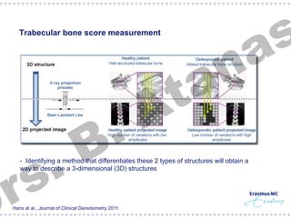 §  Trabecular bone score measurement

.
s
r

.
B

n
a
t
A

- Identifying a method that differentiates these 2 types of structures will obtain a
way to describe a 3-dimensional (3D) structures

Hans at al., Journal of Clinical Densitometry 2011

s
a

 