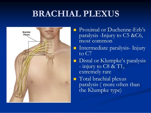 erbs palsy erb duchenne