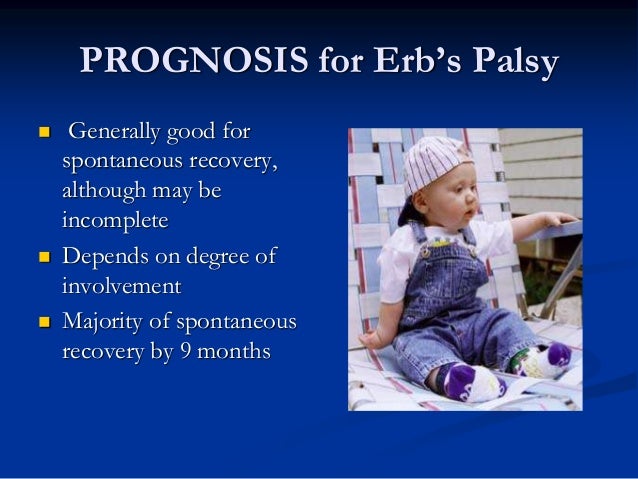 erbs palsy erbs palsy
