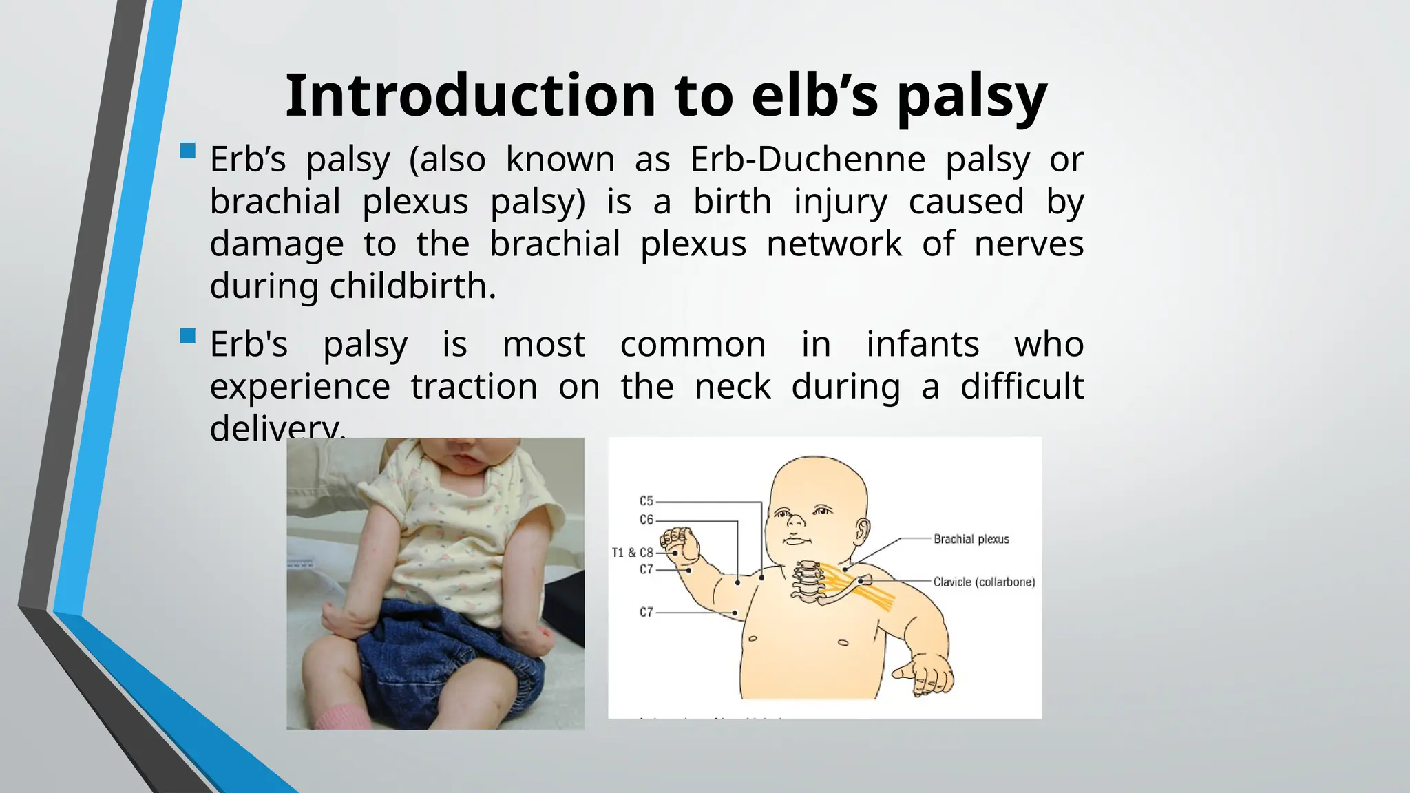 Erb's palsy Lecture notes for education purpose | PPTX