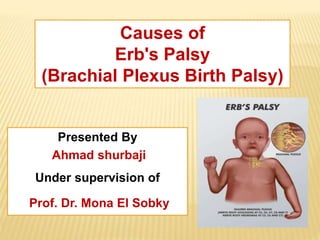 Causes of
Erb's Palsy
(Brachial Plexus Birth Palsy)
Presented By
Ahmad shurbaji
Under supervision of
Prof. Dr. Mona El Sobky
 