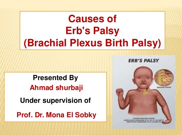 erbs palsy cause erbs palsy